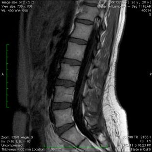 lower spine